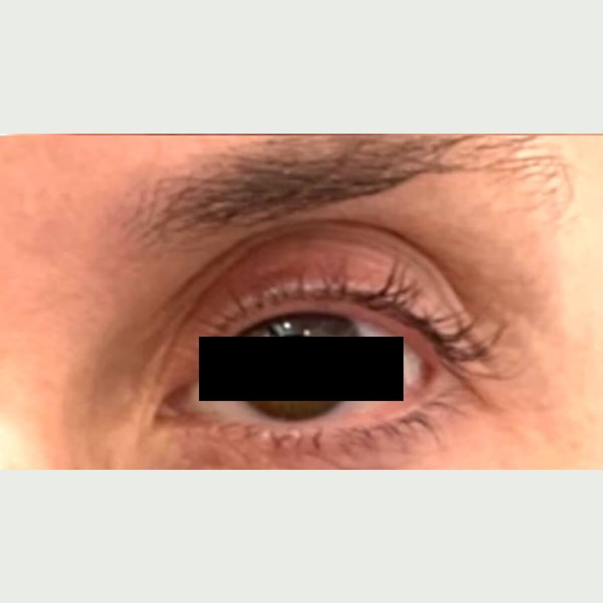Courtesy of Steve Weiner, M.D. 2 AFTER