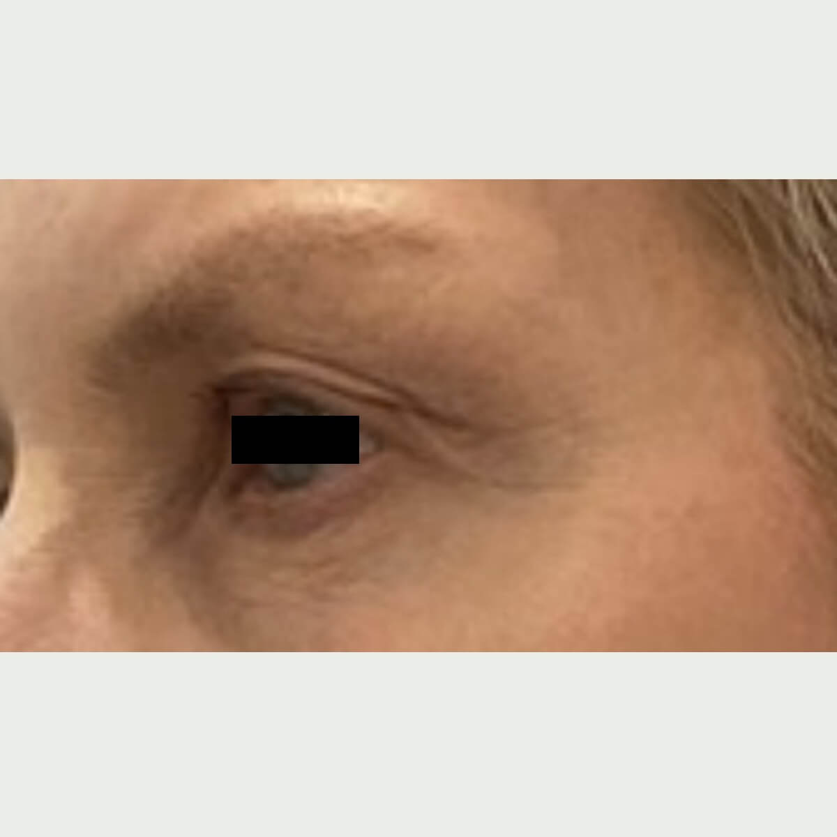 Courtesy of Steve Weiner, M.D. 3 AFTER