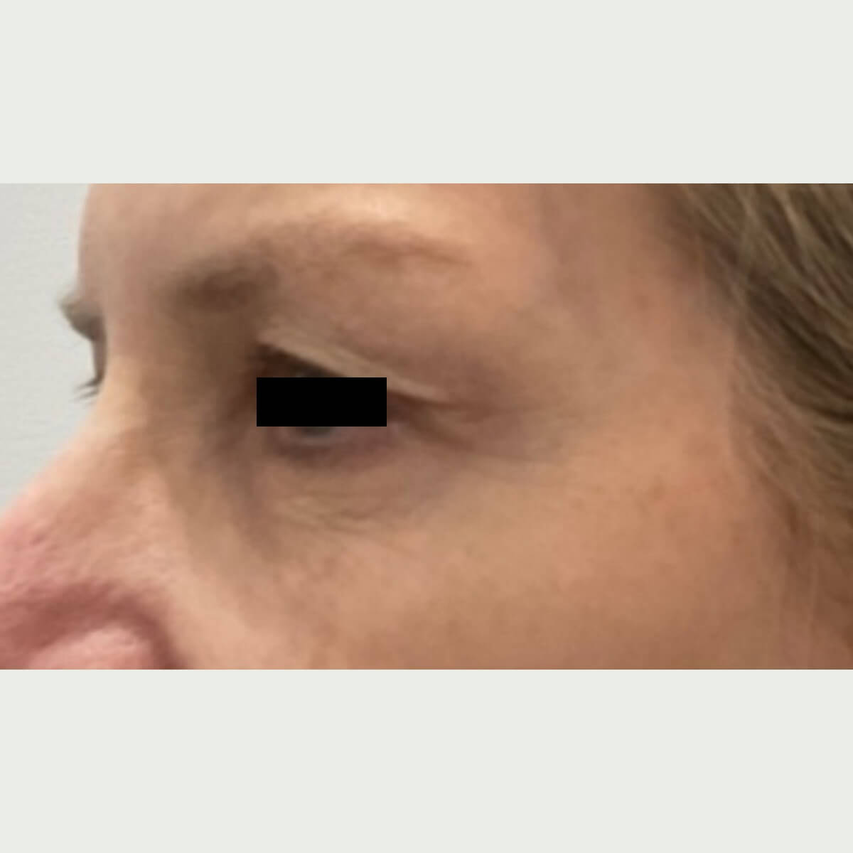 Courtesy of Steve Weiner, M.D. 3 Before