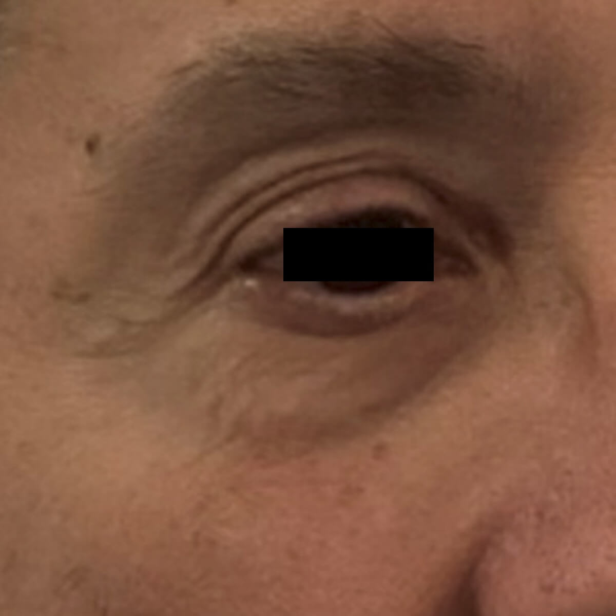 Courtesy of Steve Weiner, M.D. Before